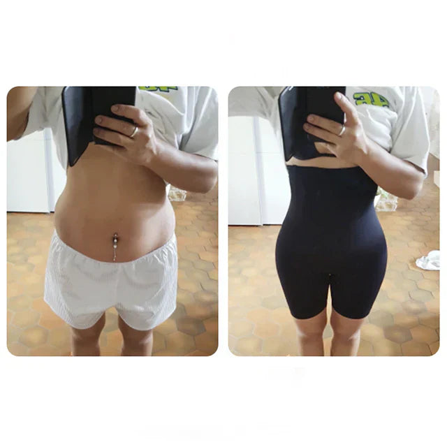 Waist Sculpting Shapewear™ - Slim Effortlessly & Embrace Your Curves